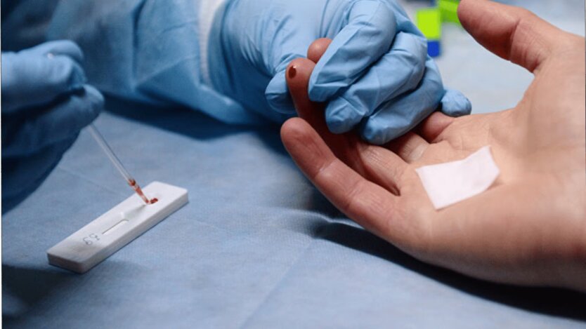 Die Stadt in Gefahr: Popenko erklärte, warum in Kiew eine Hepatitis-A-Epidemie ausgebrochen ist